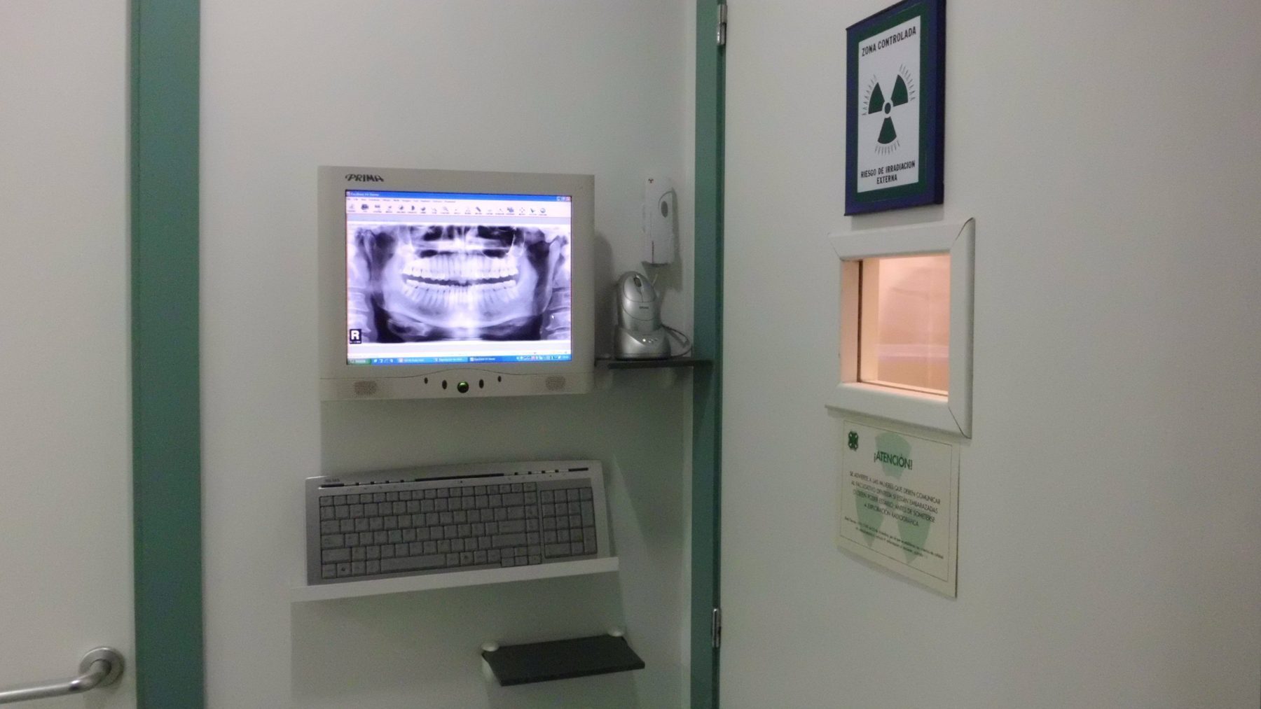 Área de radiodiagnóstico con radiografía panorámica en pantalla
